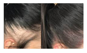 آرایش دائم در پزشکی